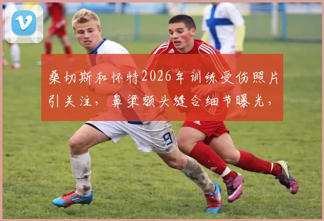 桑切斯和怀特2026年训练受伤照片引关注,鼻梁额头缝合细节曝光,专业防护讨论升温